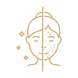 Acne and Pigmentation Treatment
